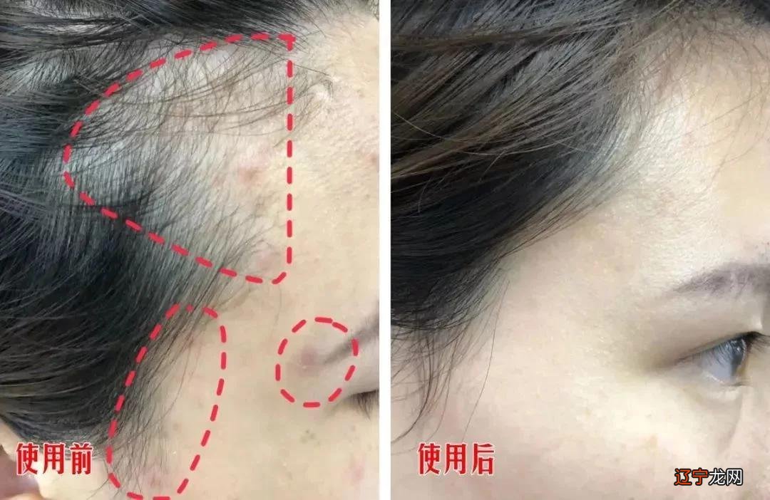 控油界的黑马！螨虫、头屑一扫而光，头发蓬松柔顺有光泽！比吹了海风还清爽！