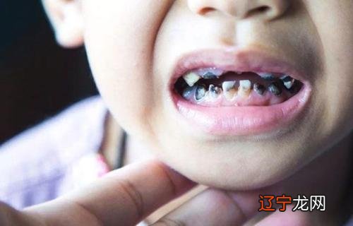 牙齿碎了只剩牙根了怎么办 牙齿碎了