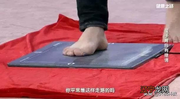 脚型矫正器-脚形