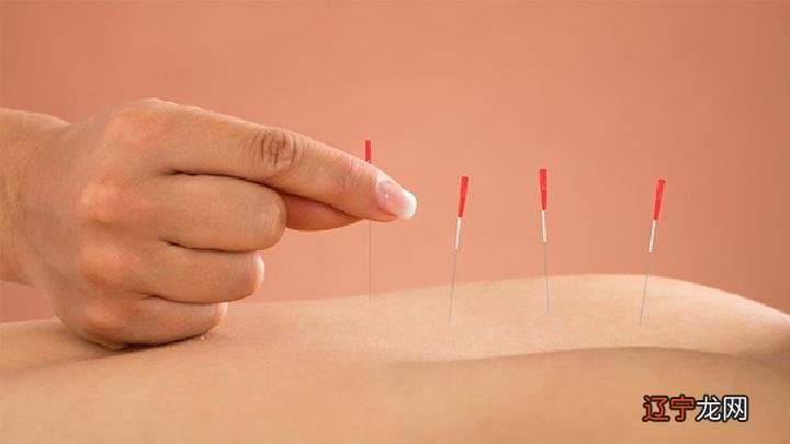 持续性耳鸣怎么用针灸治疗 中医针灸治疗持续性耳鸣的4个方法