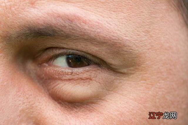 右眼下眼皮跳-右眼下眼皮跳动是怎么回事