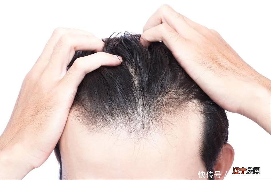 洗发时不用洗发水,头发会变得更好吗?你相信吗?你会跟风吗?