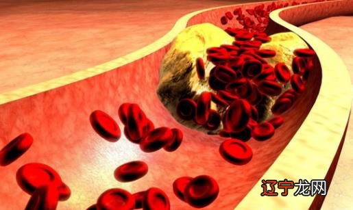 血管稍硬有什么危害?动脉硬化如何防治