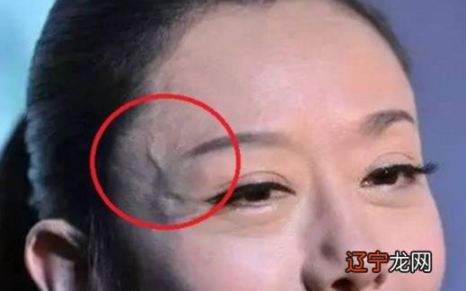 身上青筋明显说明什么情况,青筋是不是血管