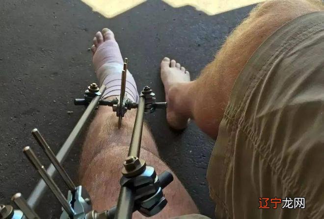 邪术or神之手：硅谷男精英的“断骨贷”，到底有多可怕？